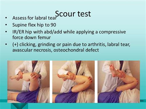 hip labrum special tests